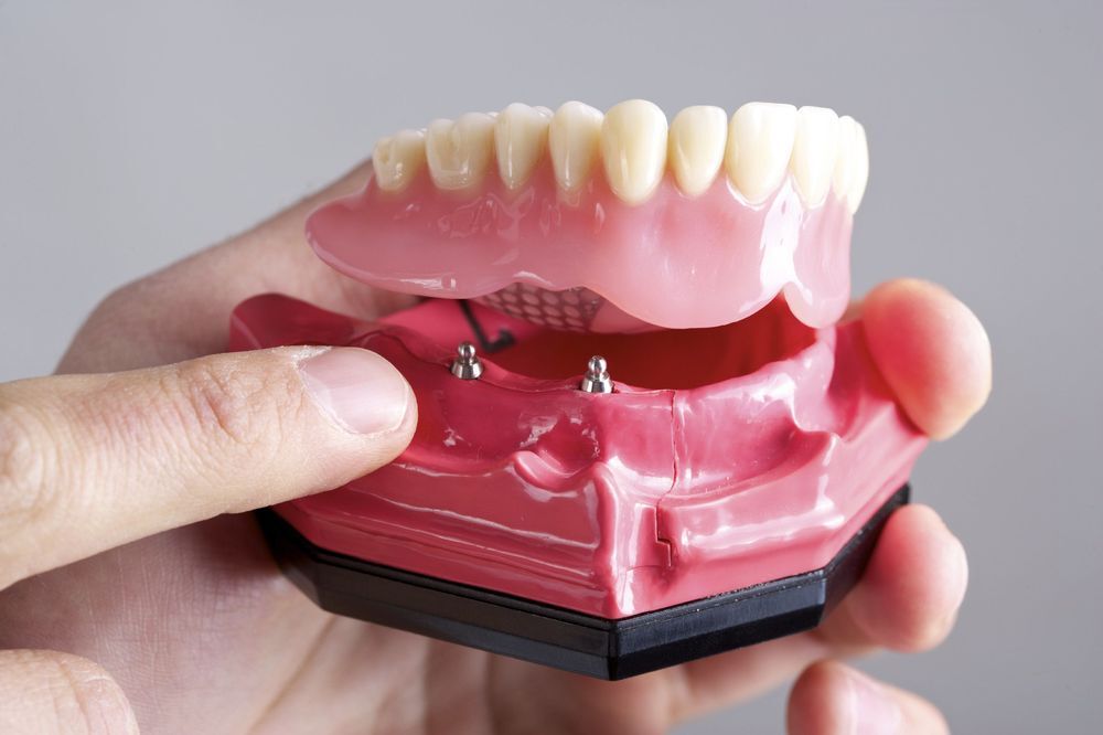 Types of Dentures