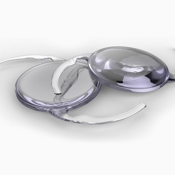 Digital illustration of two intraocular lenses
