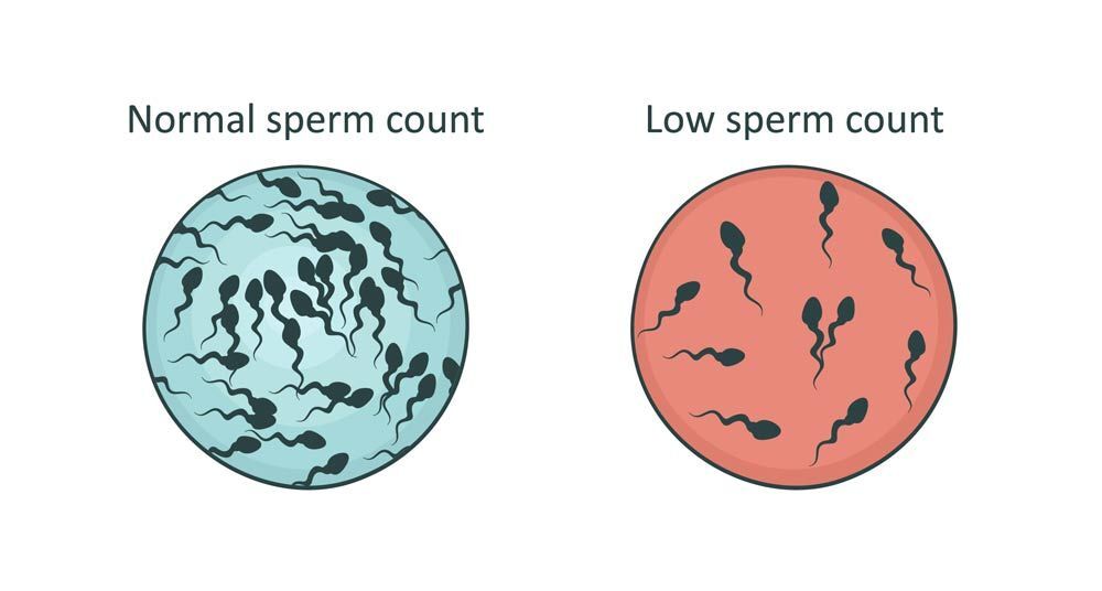 Male Infertility or Low sperm count symptoms 
