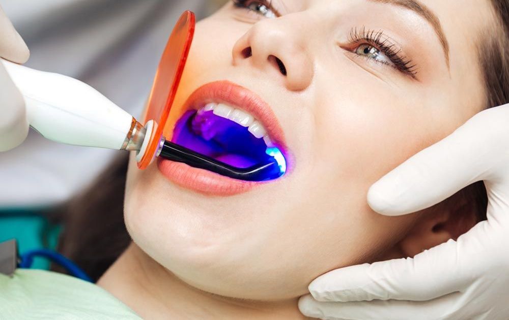 Laser Dentistry Corpus Christi, TX Robertson and Orchard, DDS
