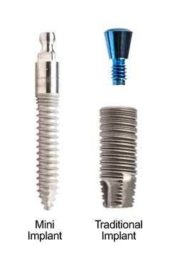 Traditional and mini dental implant. 
