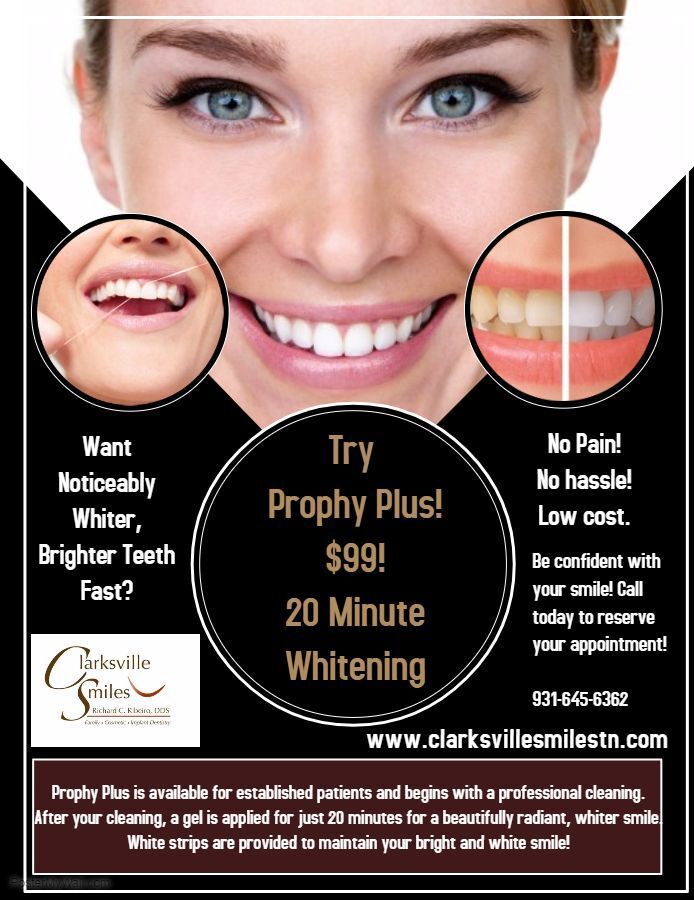 Teeth Whitening Clarksville Tn Cosmetic Dentistry