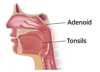 adenoid auditory tube