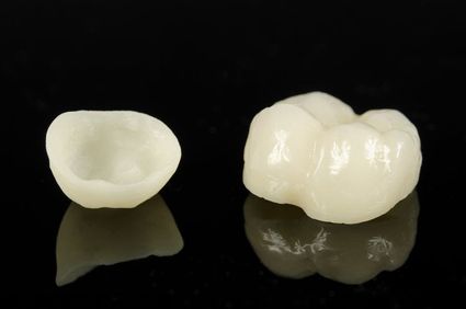 Image of dental crown
