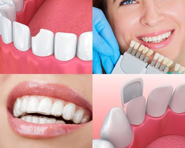 Cosmetic Dentistry - Fairfax, VA - Fairfax Family Dental Care
