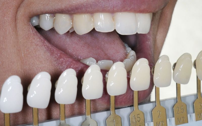 Is it ok to whiten your teeth with hydrogen peroxide