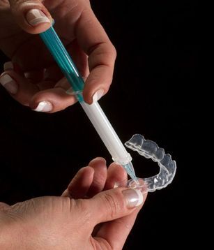 Photo of a take-home teeth whitening kit being used